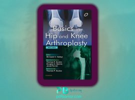 دانلود پی دی اف کتاب PDF Hip arthroplasty
